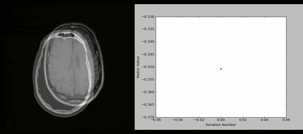 SimpleITK animation SimpleITK animation